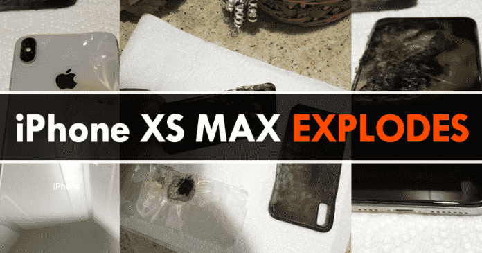 OMG! iPhone XS Max Allegedly Explodes In Owner’s Pocket OMG! iPhone XS Max Allegedly Explodes In Owner’s Pocket